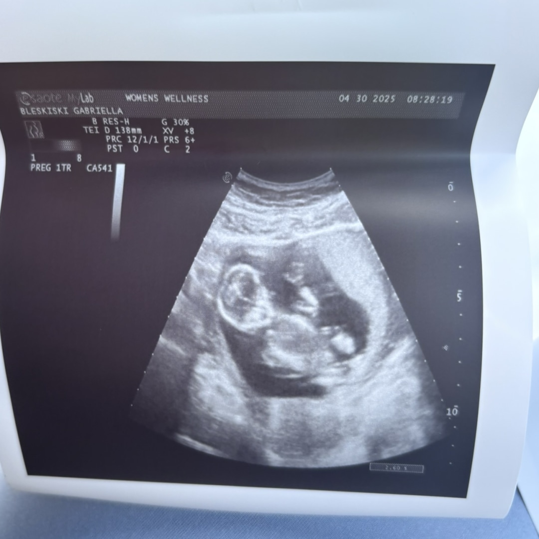 Photo shared by Gabriella for their Babylist baby registry.