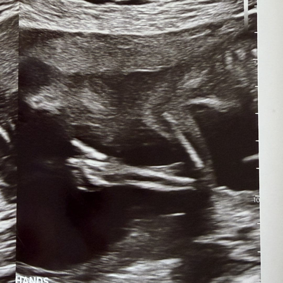 Photo shared by Olivia for their Babylist baby registry.