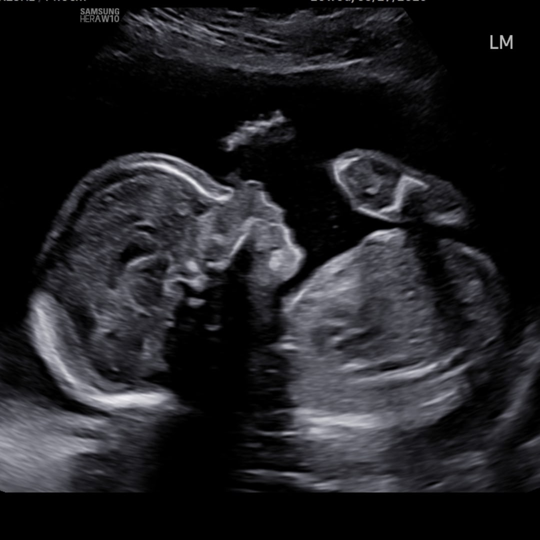 Photo shared by Hannah for their Babylist baby registry.