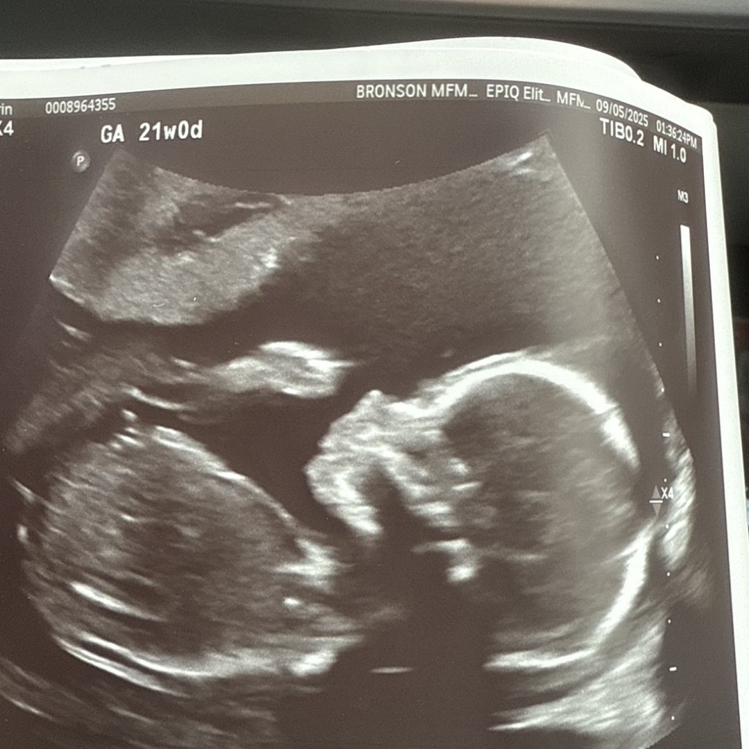 Photo shared by Ashley for their Babylist baby registry.