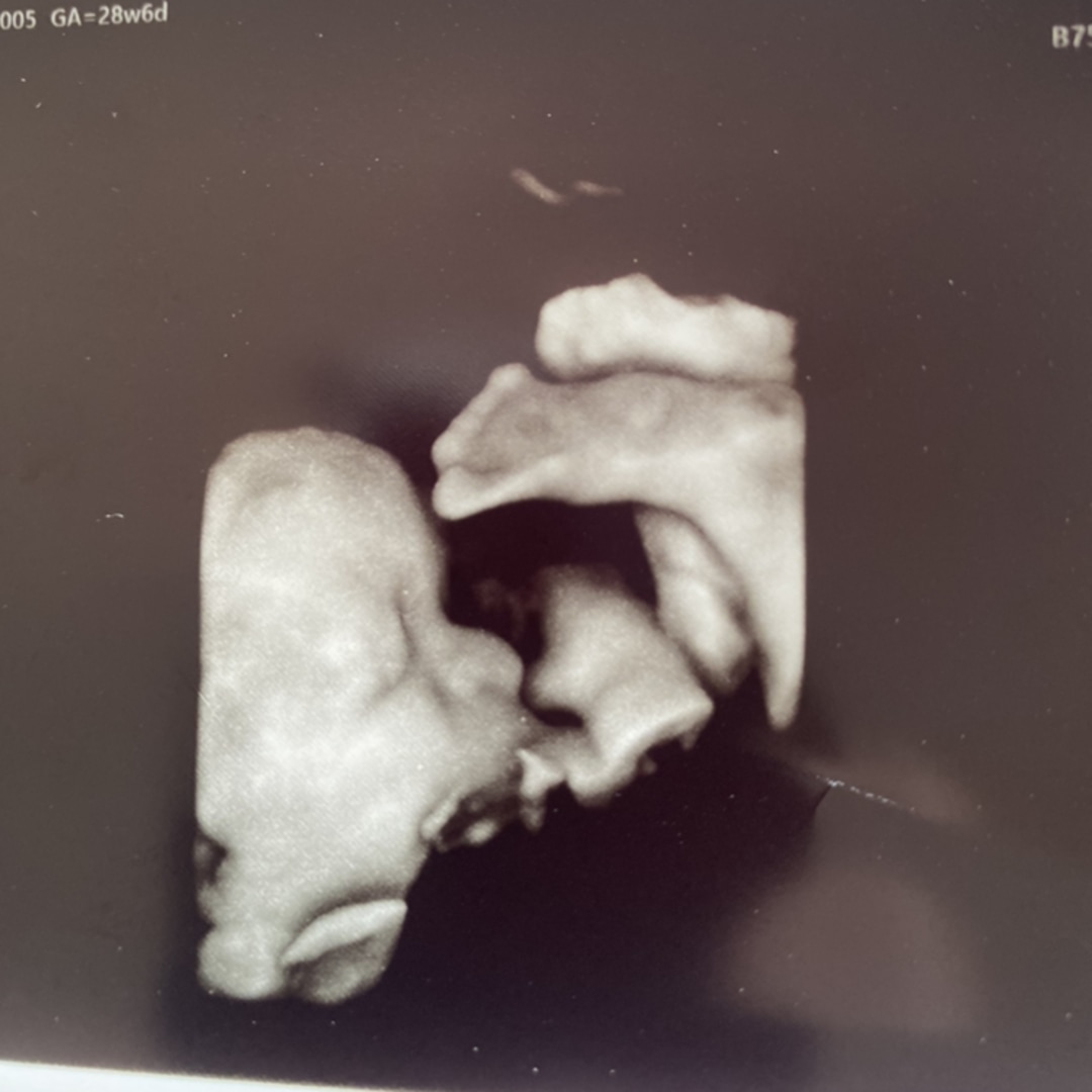 Photo shared by Carolyn ‘Cj’ for their Babylist baby registry.