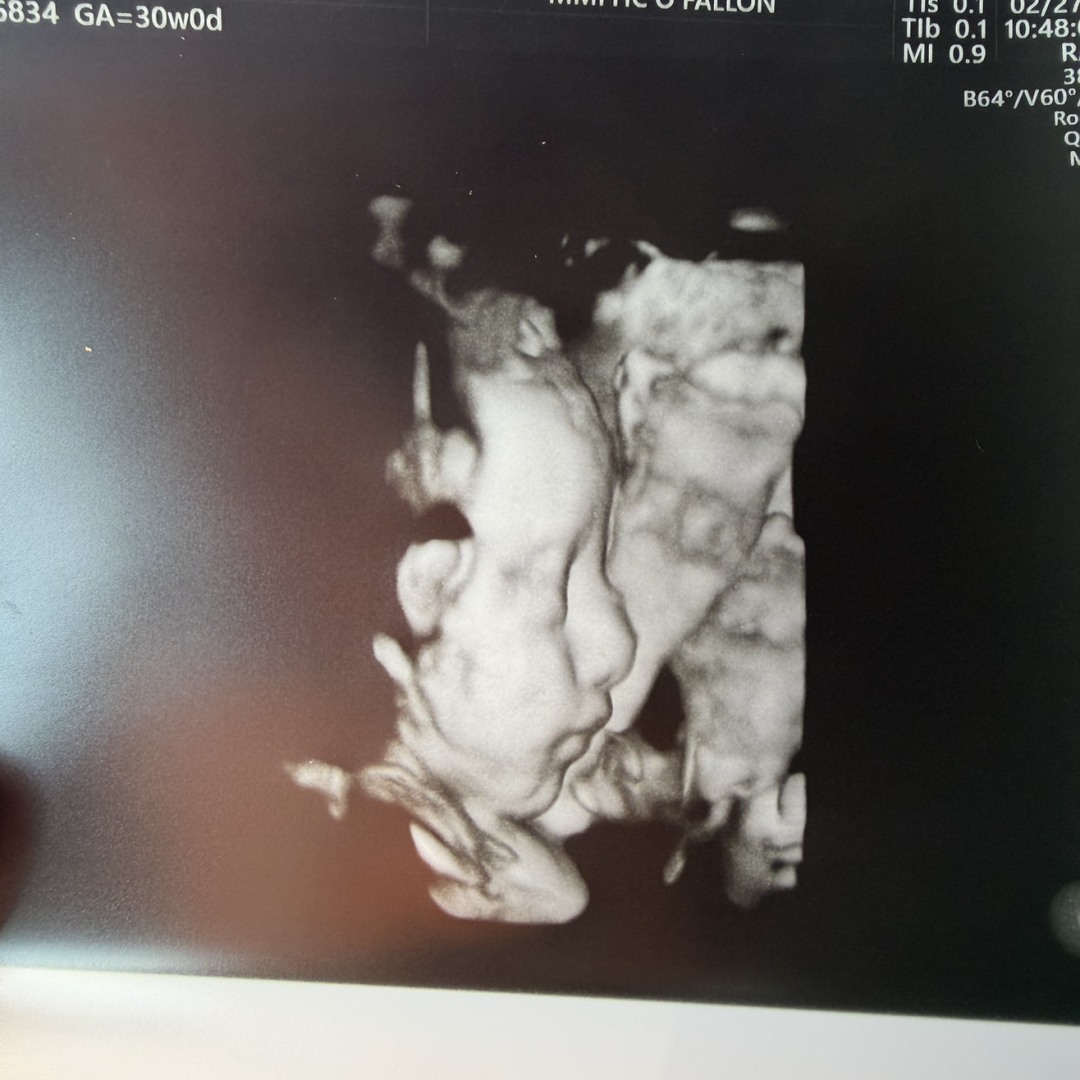 Photo shared by Bryanna for their Babylist baby registry.