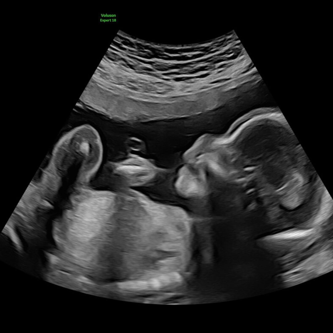 Photo shared by Chana for their Babylist baby registry.