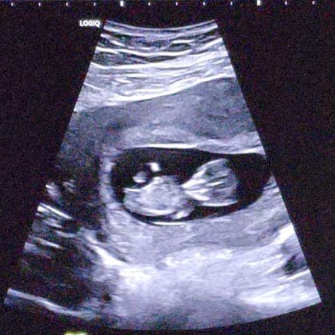 Photo shared by Alberto for their Babylist baby registry.