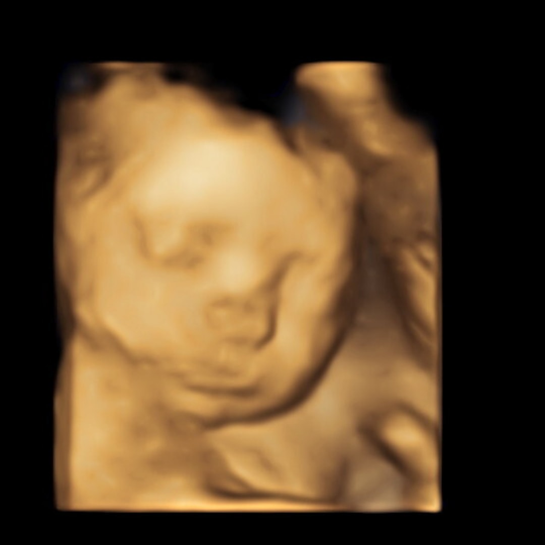 Photo shared by Brynn for their Babylist baby registry.