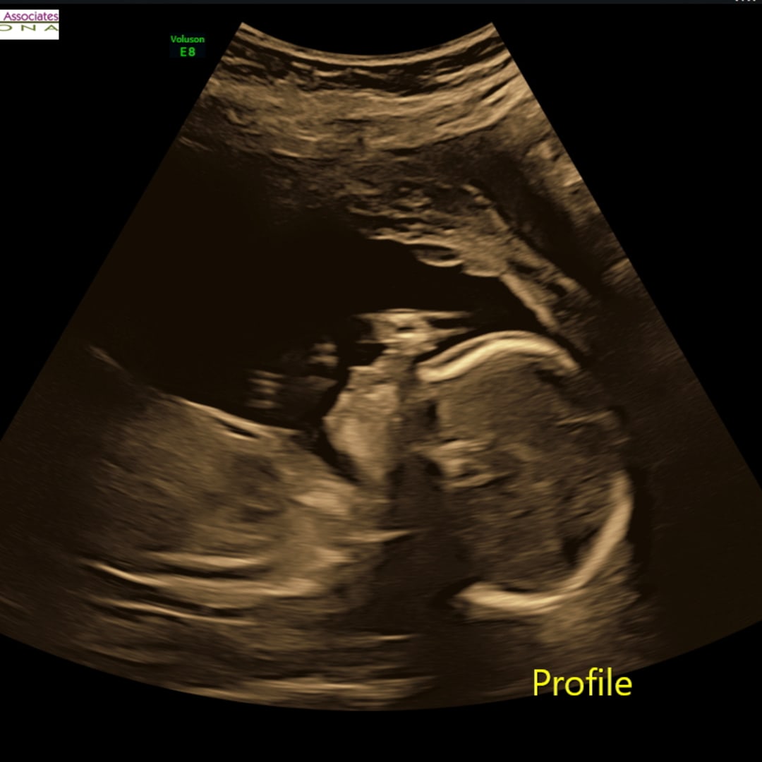 Photo shared by Adriana for their Babylist baby registry.