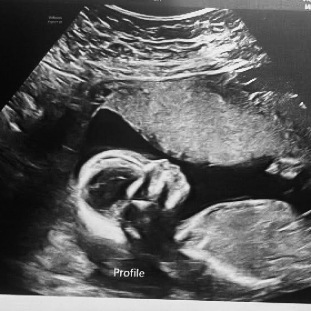 Photo shared by Alexis for their Babylist baby registry.