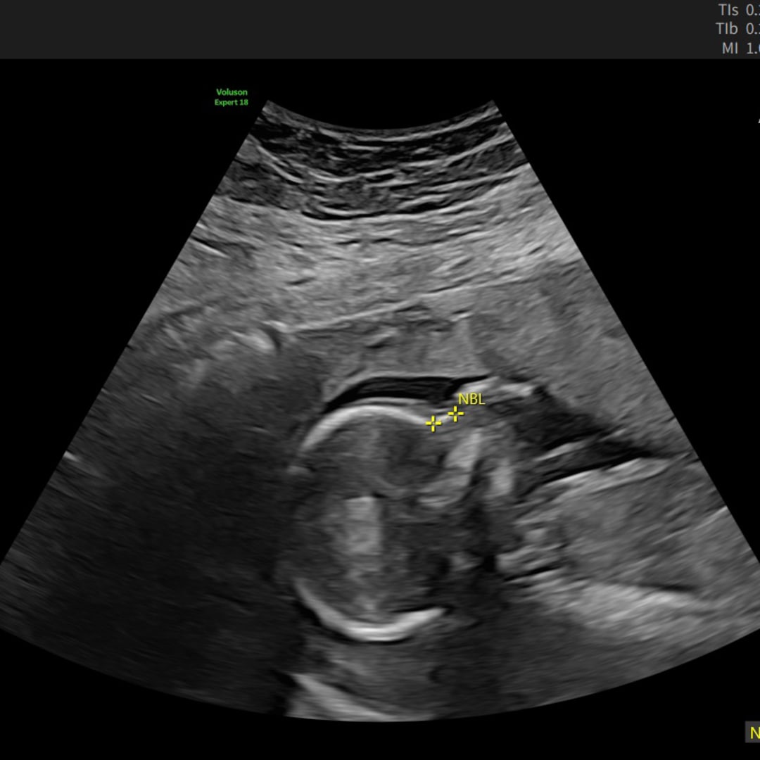 Photo shared by Jazmine for their Babylist baby registry.