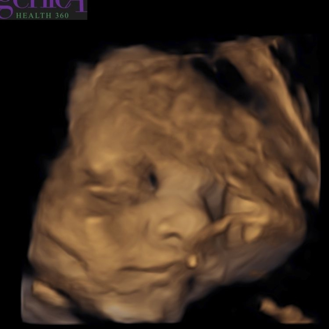 Photo shared by Alexandrea for their Babylist baby registry.