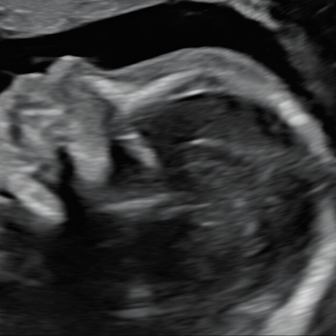 Photo shared by Jessica for their Babylist baby registry.