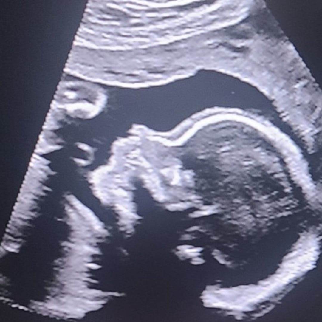 Photo shared by Elijah for their Babylist baby registry.