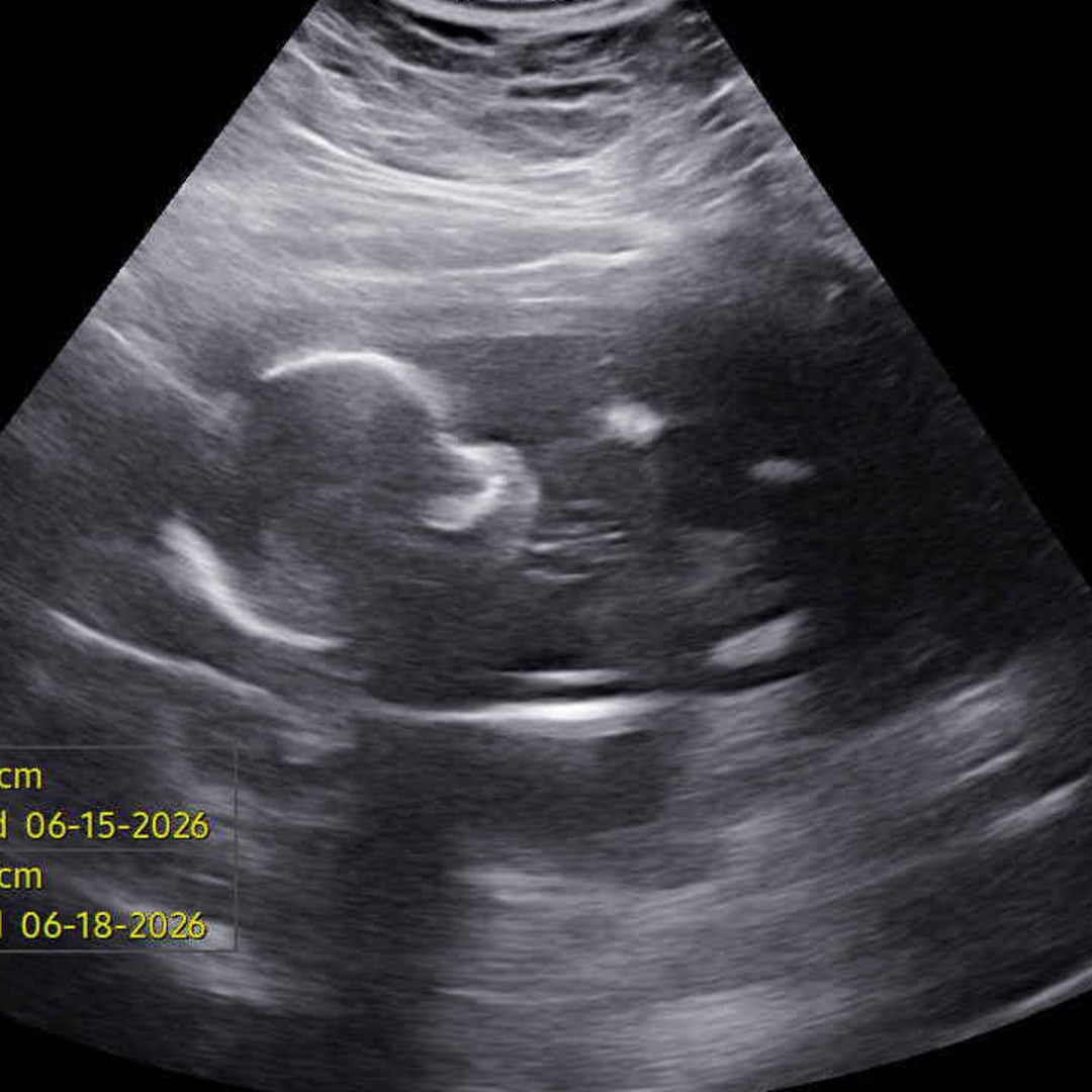 Photo shared by Samantha for their Babylist baby registry.