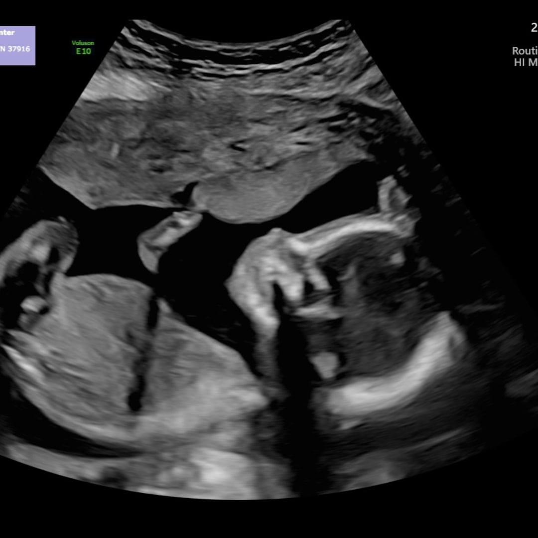 Photo shared by Alyssa for their Babylist baby registry.