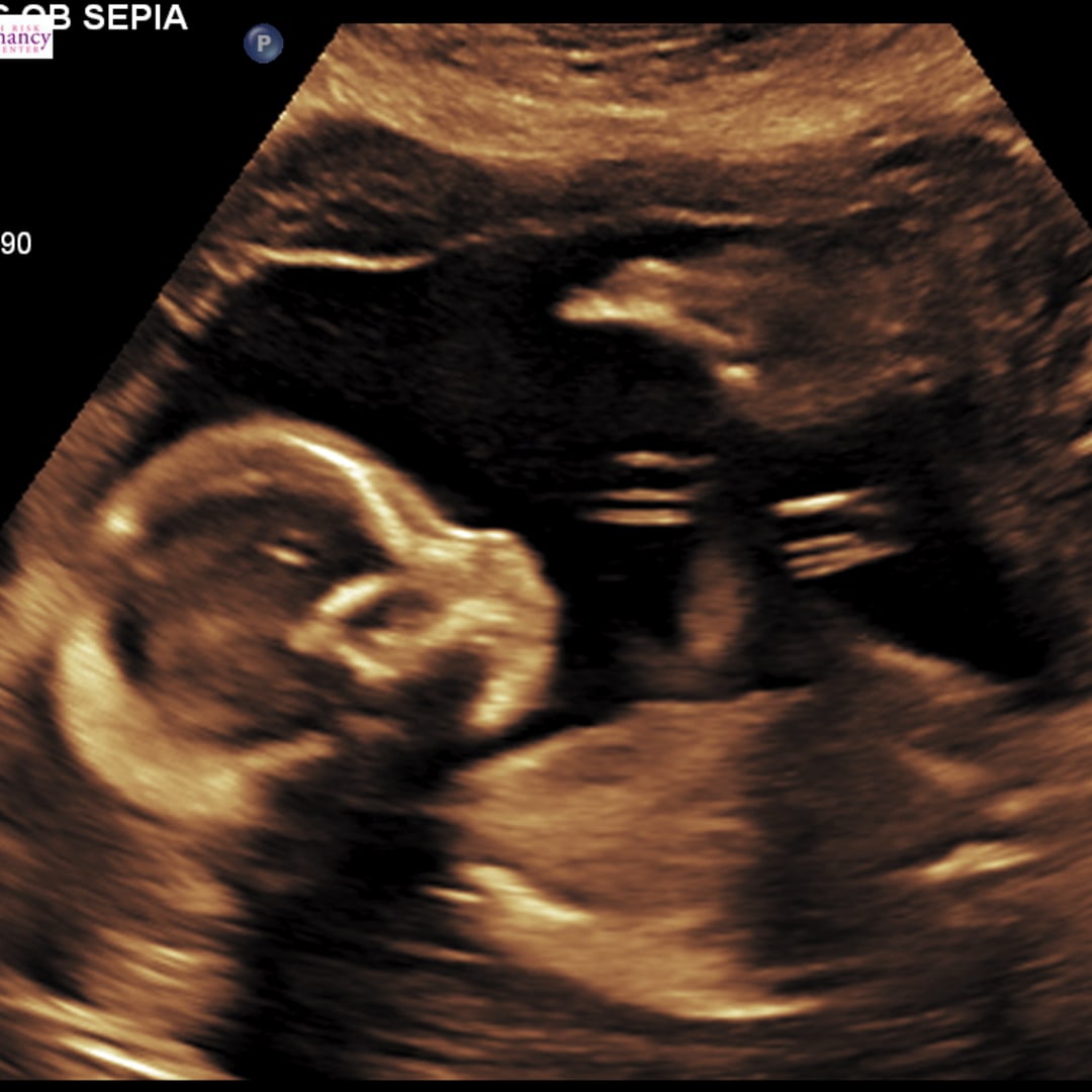 Photo shared by Hope for their Babylist baby registry.