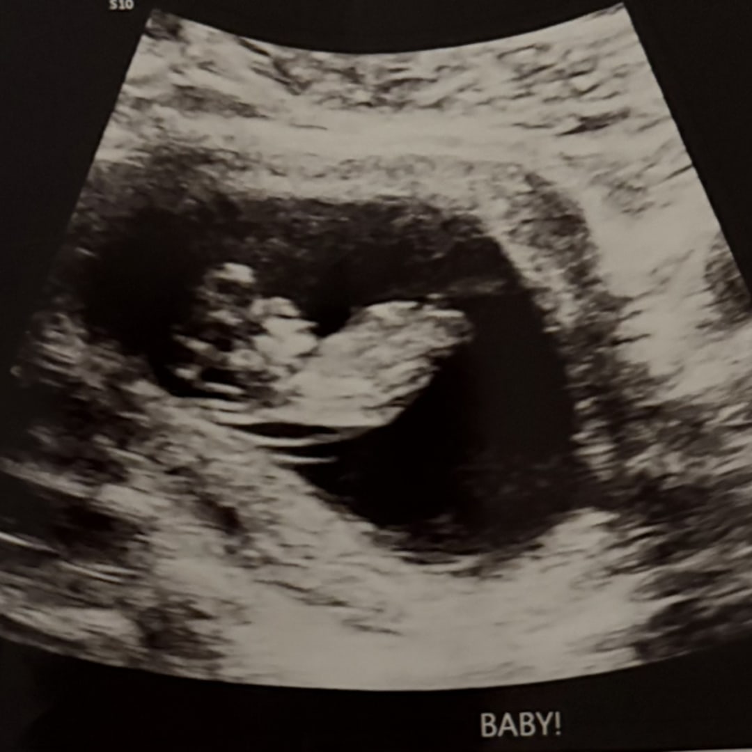 Photo shared by Anieda for their Babylist baby registry.