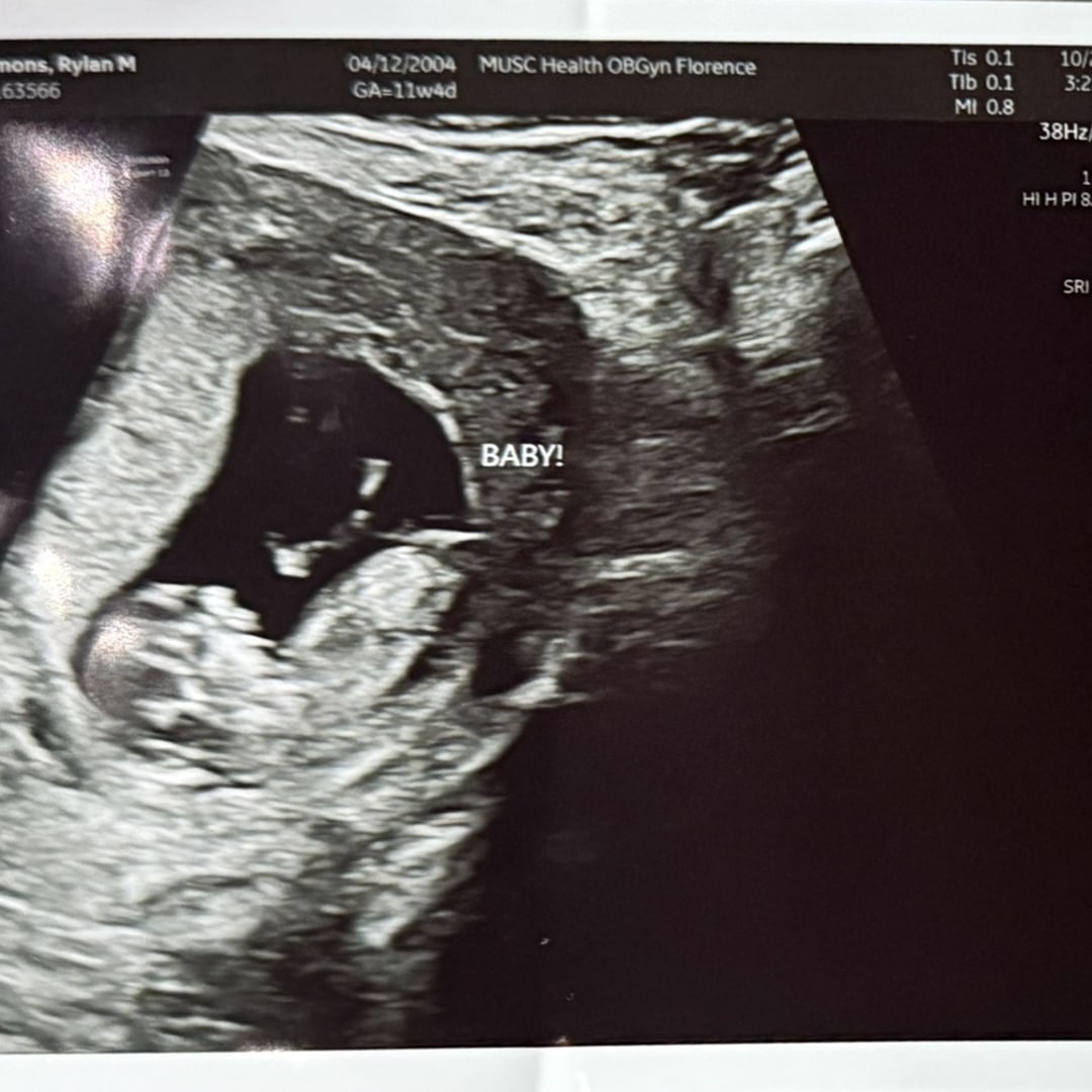 Photo shared by Alex for their Babylist baby registry.