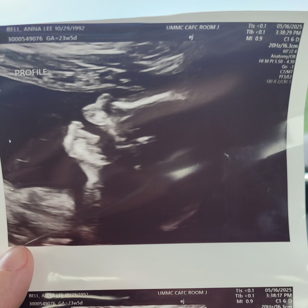 Photo shared by Anna for their Babylist baby registry.