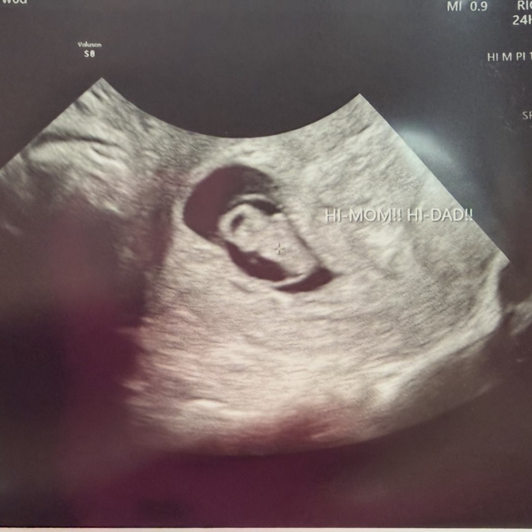 Photo shared by Charmaine for their Babylist baby registry.
