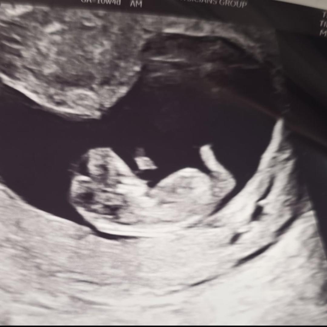 Photo shared by Ashley for their Babylist baby registry.