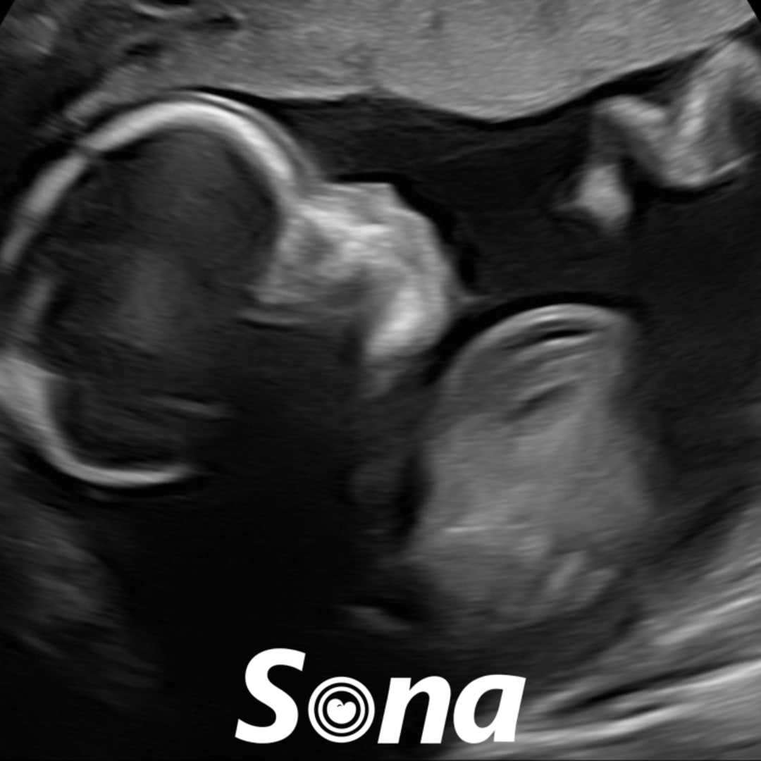 Photo shared by Ashley for their Babylist baby registry.