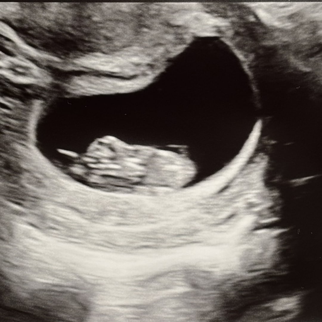 Photo shared by Selena for their Babylist baby registry.