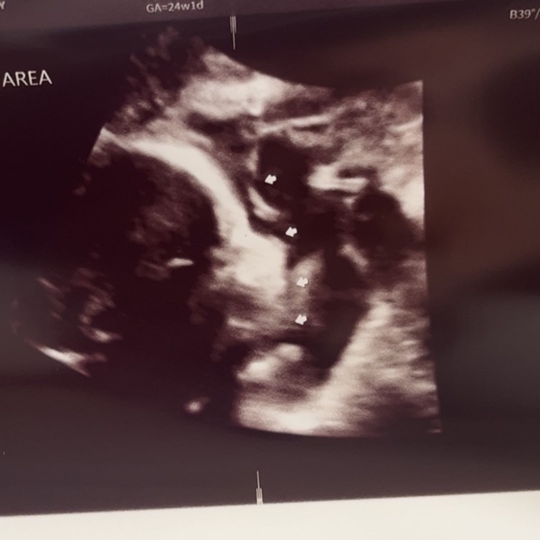 Photo shared by Amy for their Babylist baby registry.