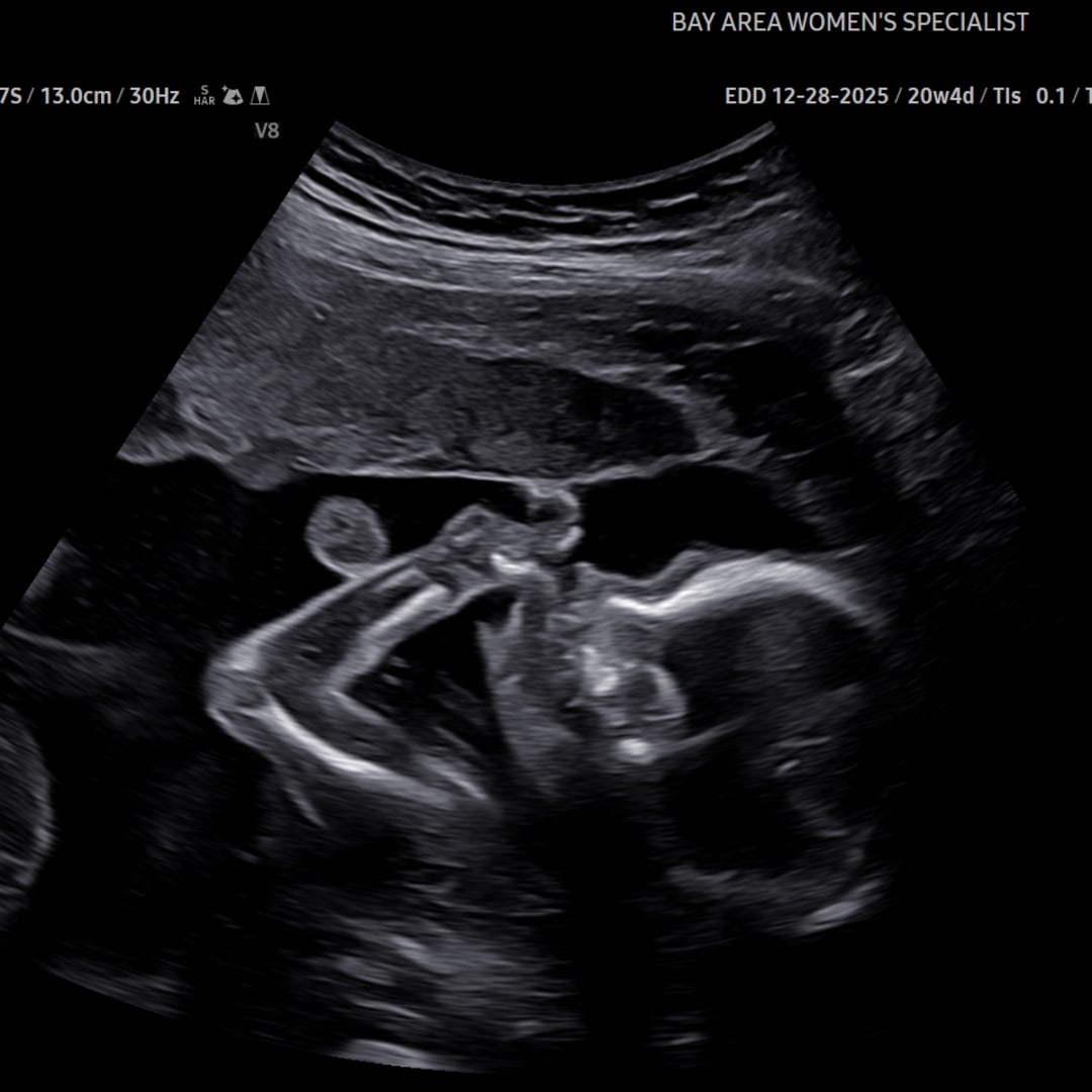 Photo shared by Alexis for their Babylist baby registry.