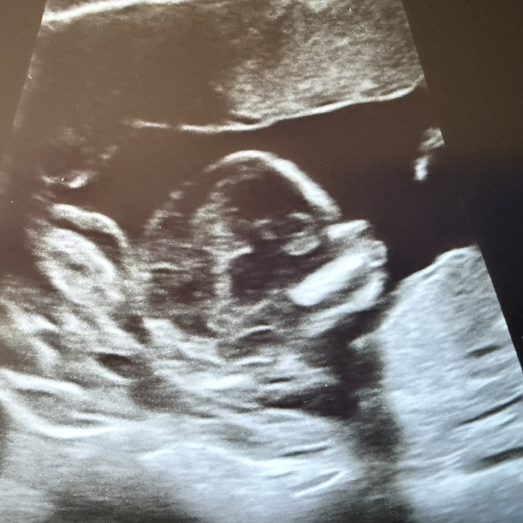 Photo shared by Emi for their Babylist baby registry.