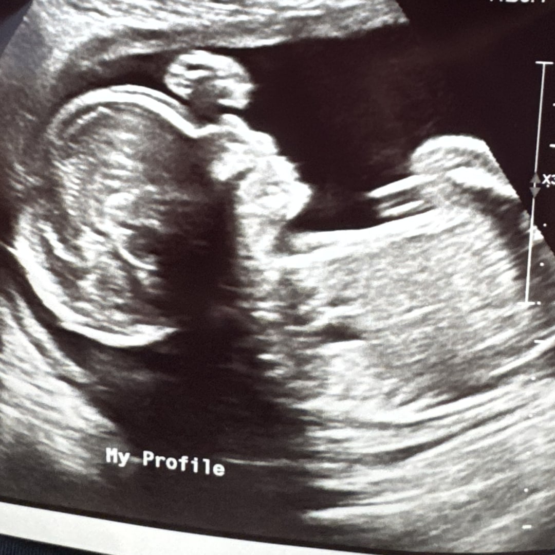 Photo shared by Deja for their Babylist baby registry.