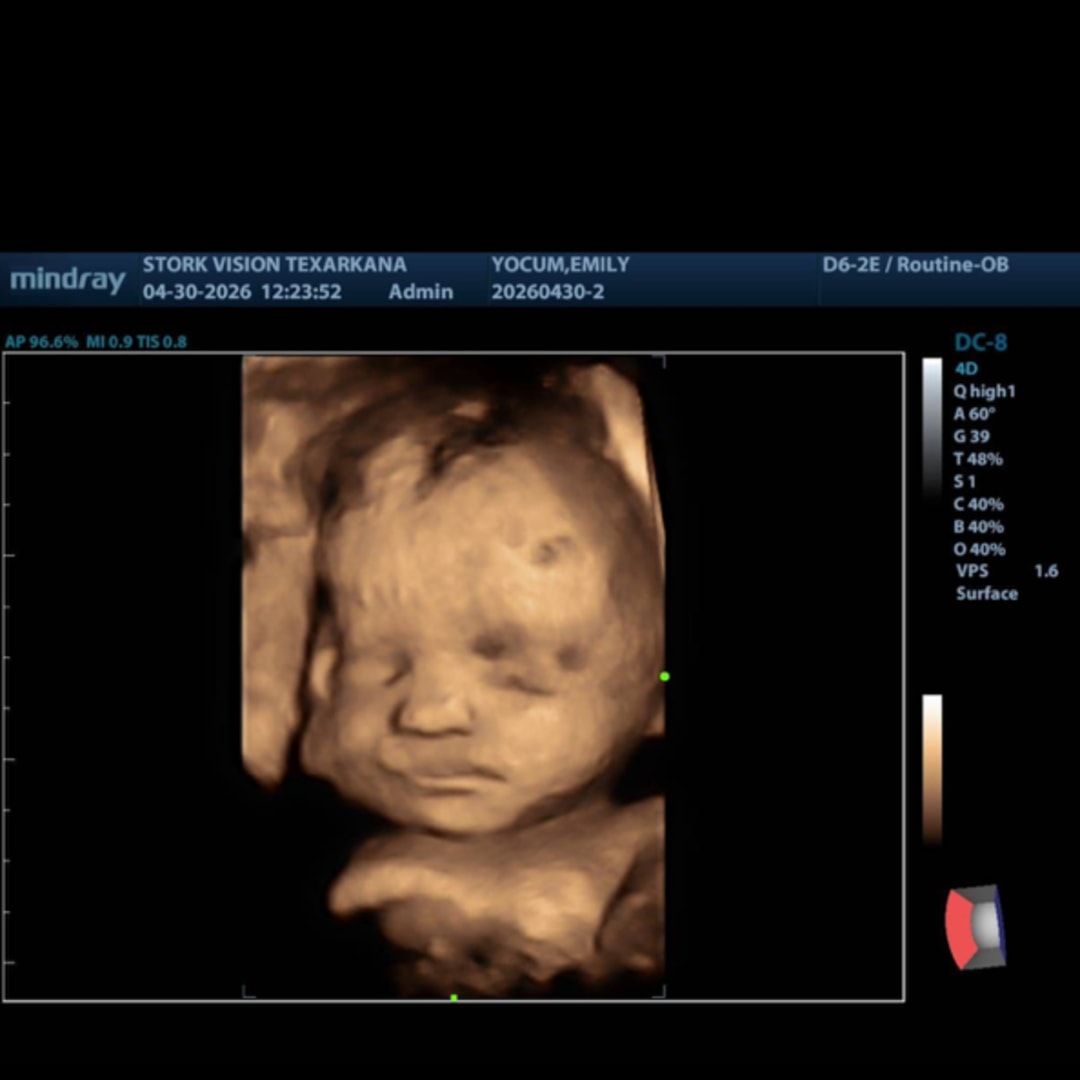 Photo shared by Emily for their Babylist baby registry.