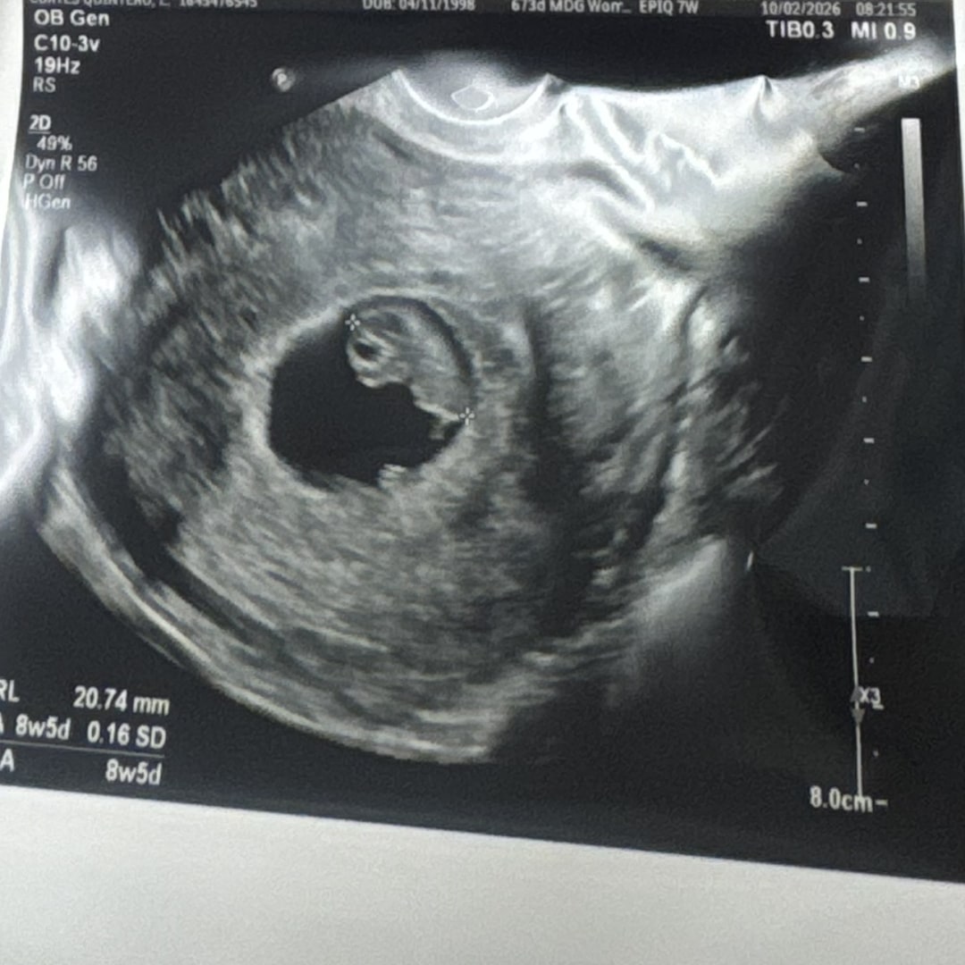 Photo shared by Analy for their Babylist baby registry.