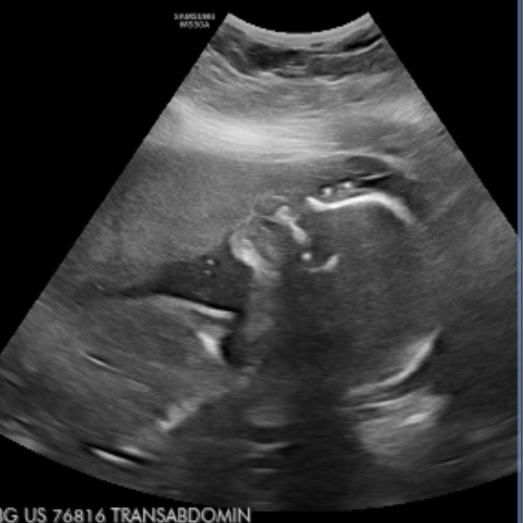 Photo shared by Emily for their Babylist baby registry.