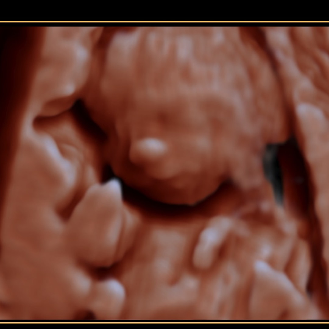 Photo shared by Hannah for their Babylist baby registry.
