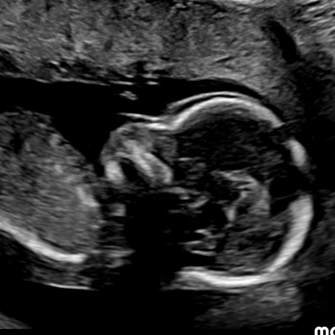 Photo shared by Dakota for their Babylist baby registry.