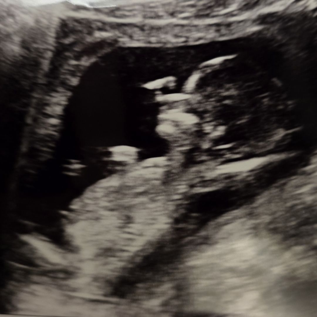 Photo shared by Reesiel for their Babylist baby registry.