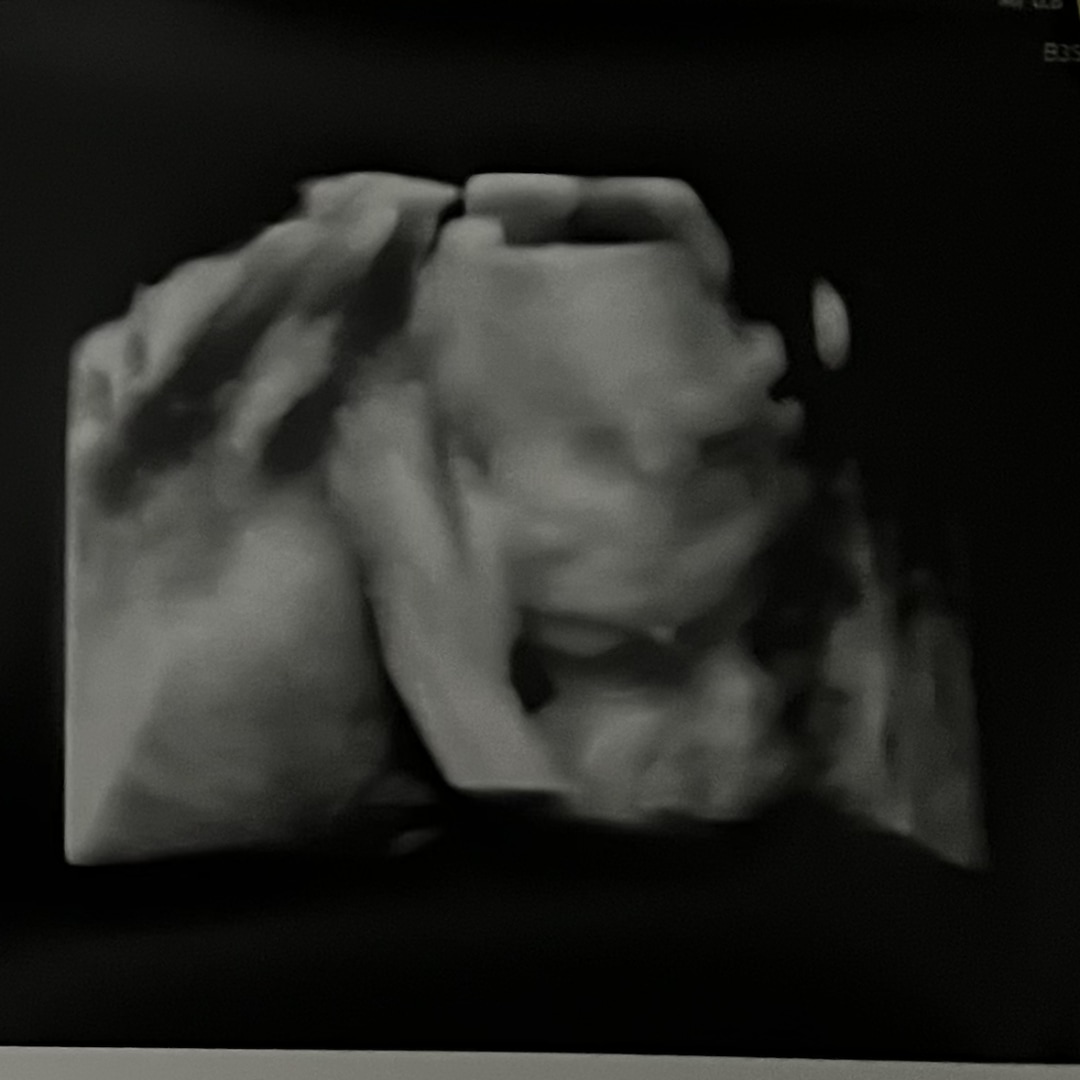 Photo shared by Yazmine for their Babylist baby registry.