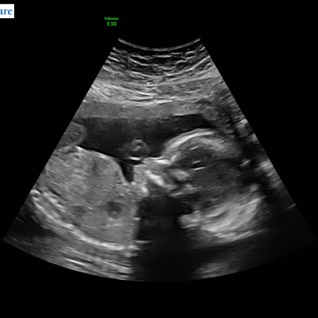 Photo shared by Allie for their Babylist baby registry.