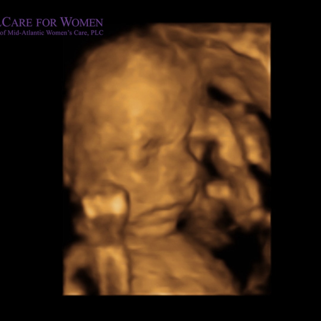 Photo shared by Chelsey for their Babylist baby registry.