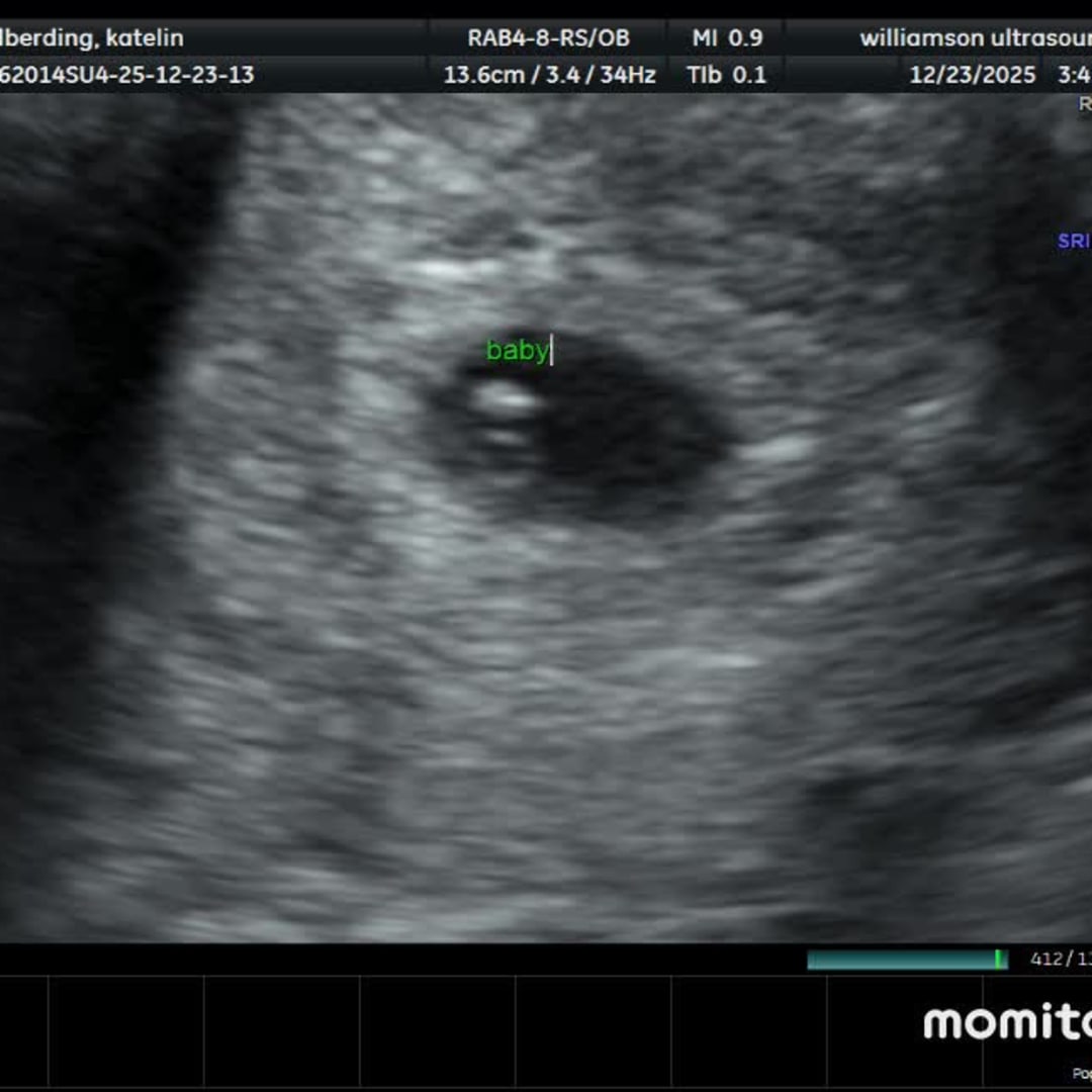 Photo shared by Katelin for their Babylist baby registry.