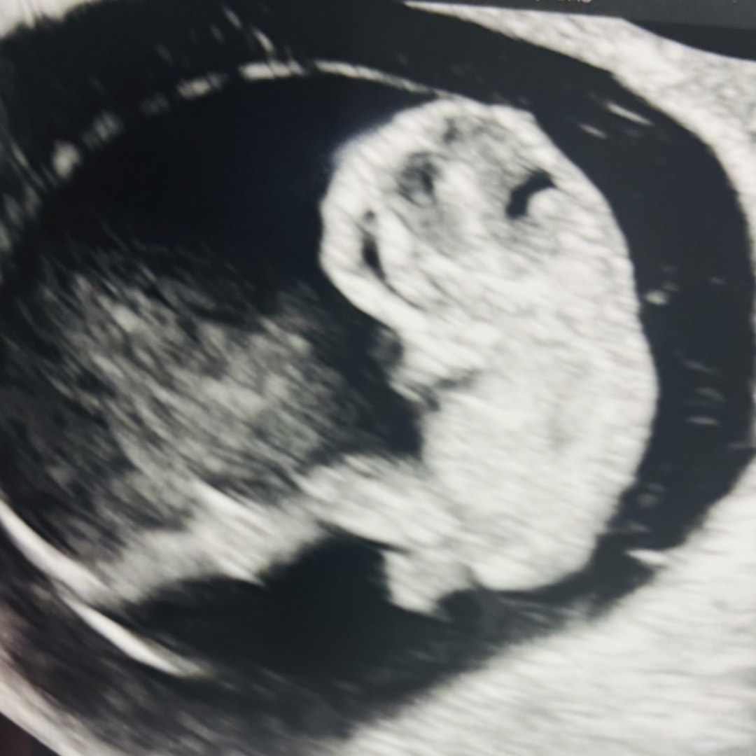 Photo shared by Felicia for their Babylist baby registry.