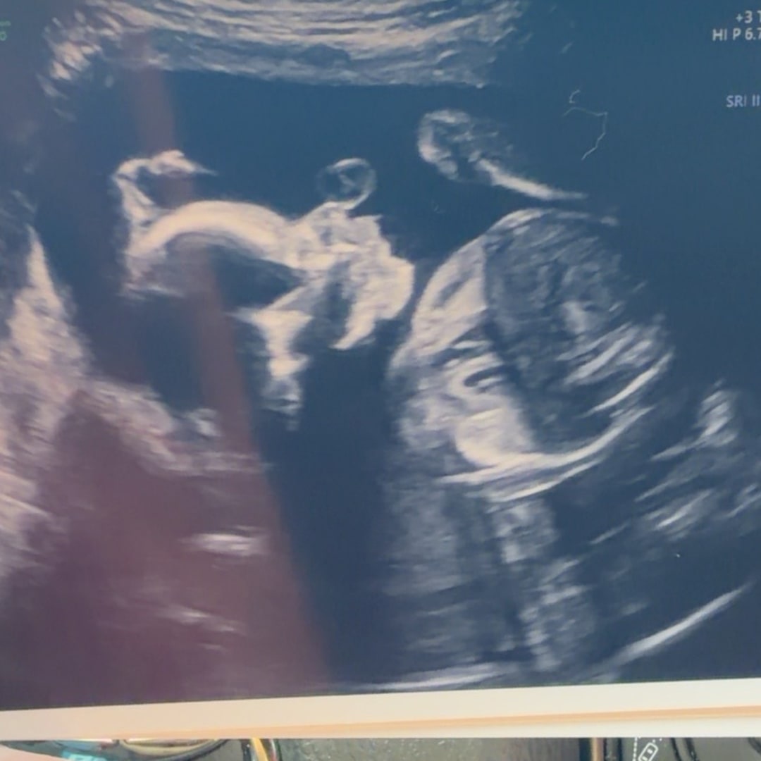 Photo shared by Ariel for their Babylist baby registry.
