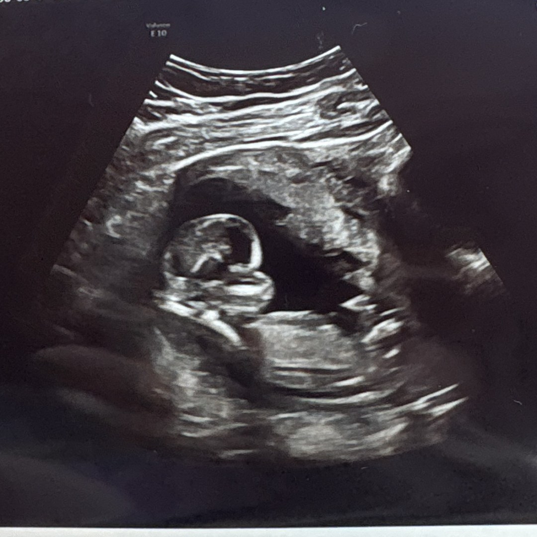 Photo shared by Rebecca for their Babylist baby registry.