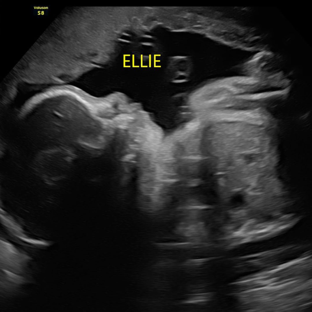 Photo shared by Alyssa for their Babylist baby registry.