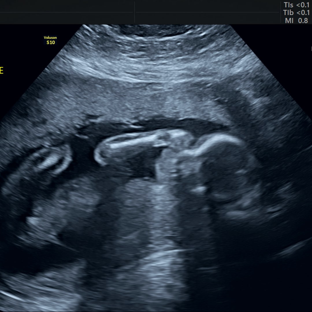 Photo shared by Lauren for their Babylist baby registry.