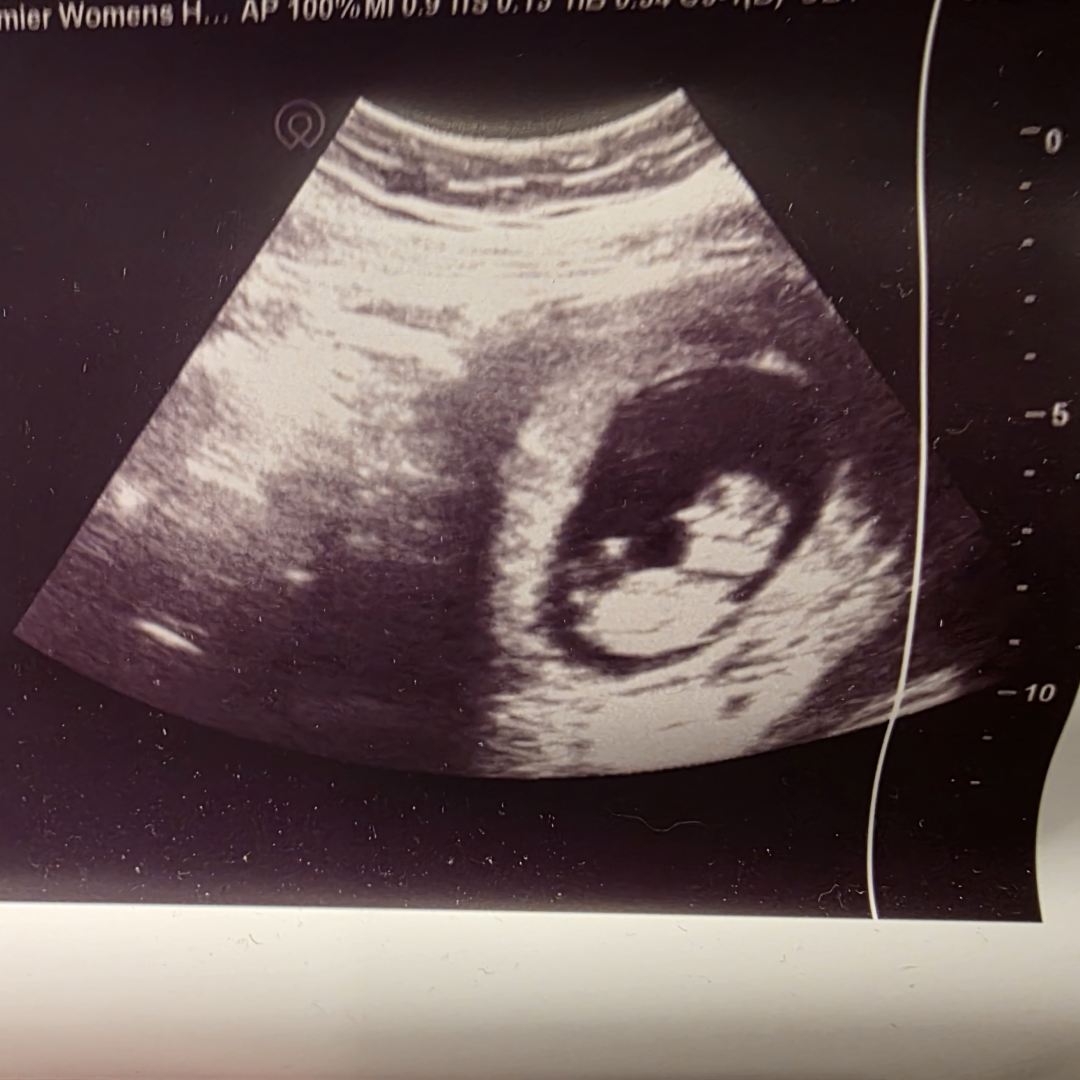 Photo shared by Chelsee for their Babylist baby registry.