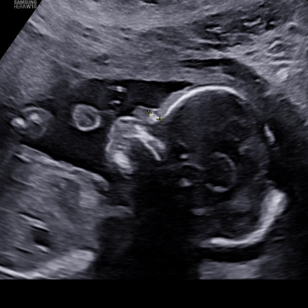 Photo shared by Kyra for their Babylist baby registry.