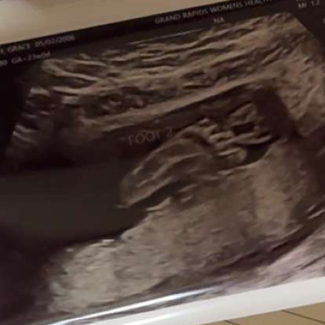 Photo shared by Grace for their Babylist baby registry.