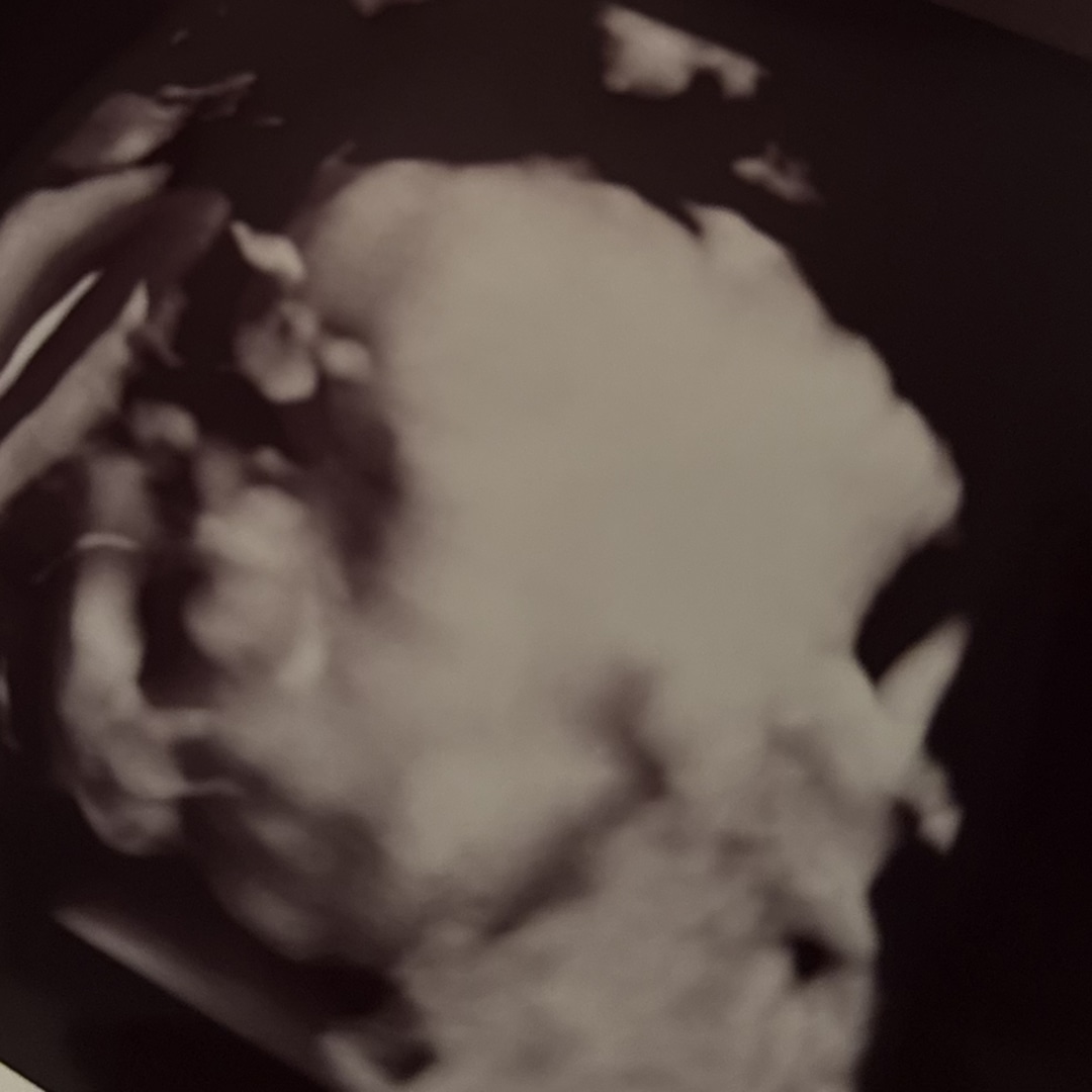 Photo shared by Brittany for their Babylist baby registry.