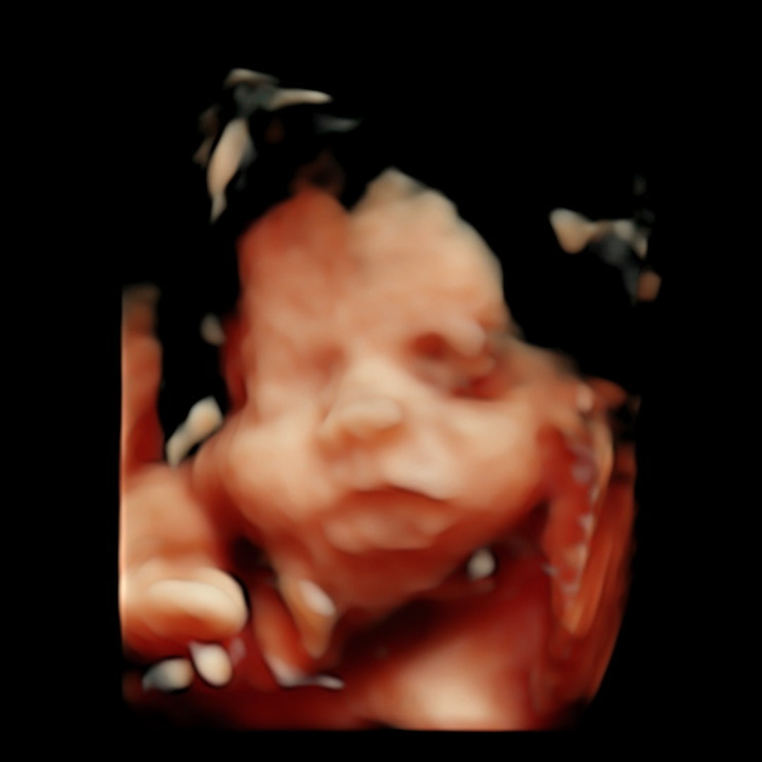 Photo shared by Hannah for their Babylist baby registry.