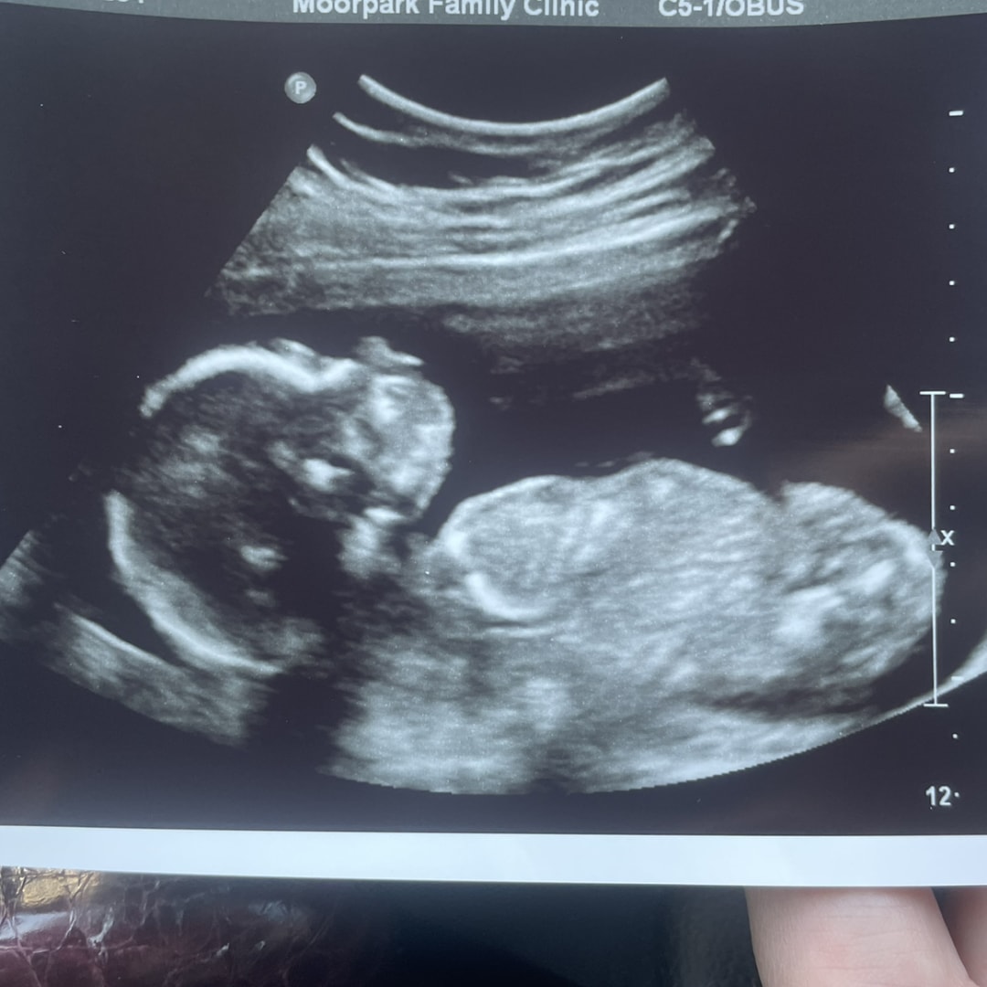 Photo shared by Chelsea for their Babylist baby registry.